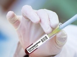 Stosowanie metforminy u pacjentów z cukrzycą typu II może zmniejszyć ryzyko śmierci na Covid19? metofrmina a koronawirus